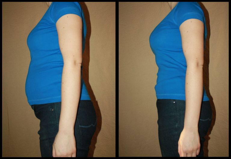 Bloated and flat female belly before and after from the side, no ...